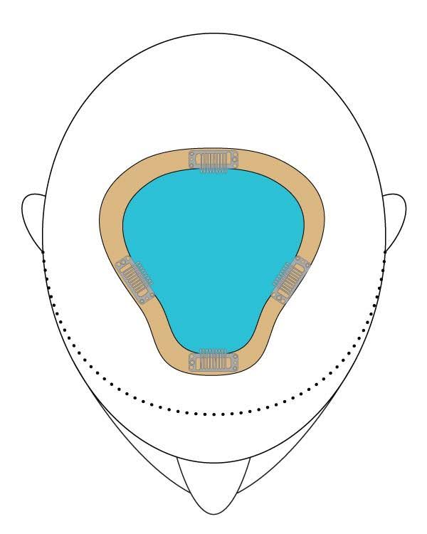 HD XL 12 O7799